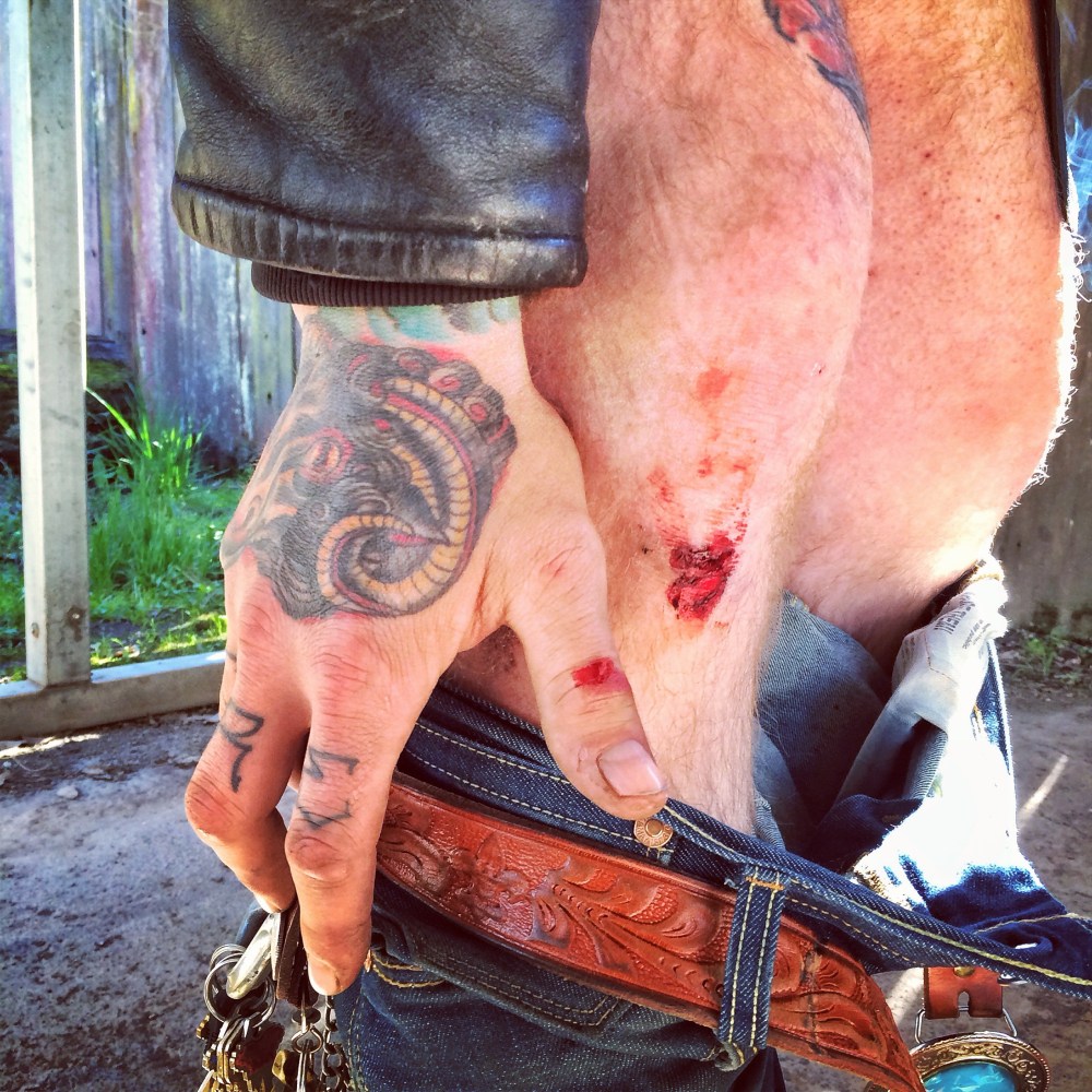 John's broken thumb and bloods after our classy crash in Sonoma. 